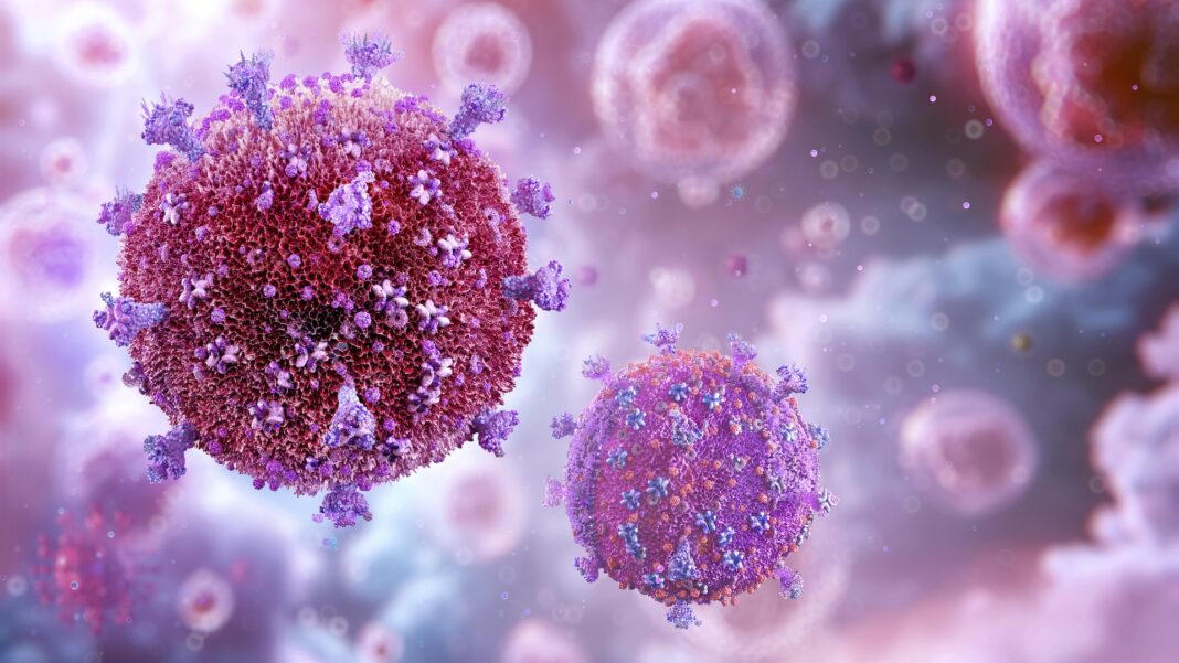 HIV AIDS