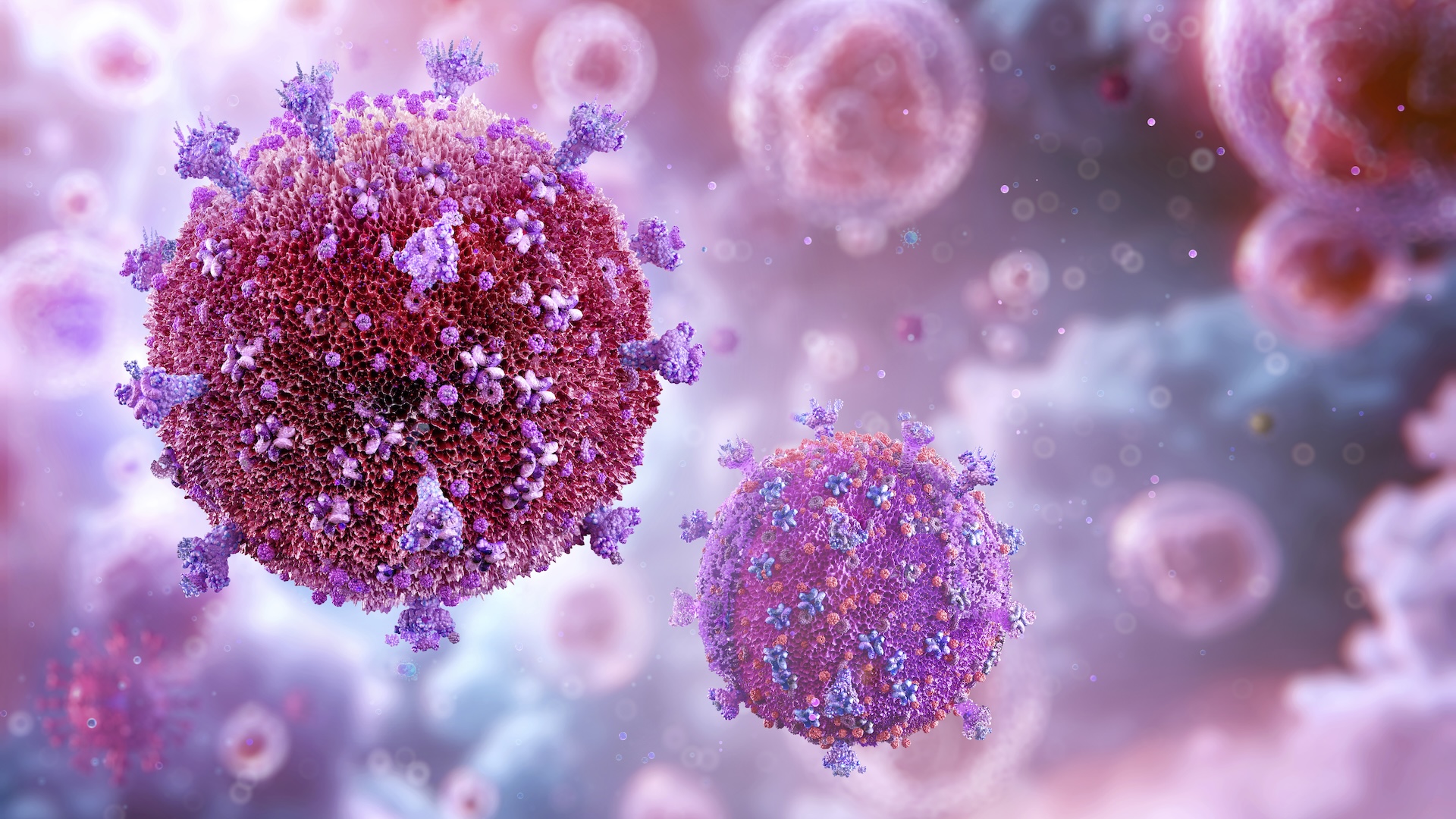 HIV AIDS