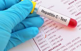 Eliminating hepatitis