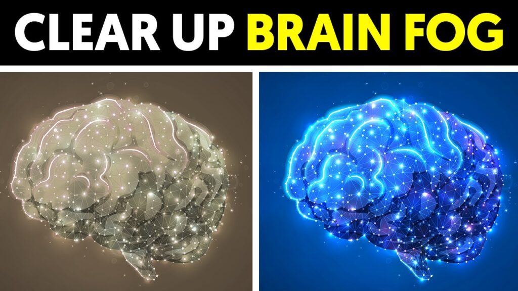 10 Reasons You Might Have Brain Fog (and What You Can Do About It ...