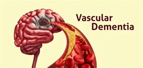 What Is Vascular Dementia?